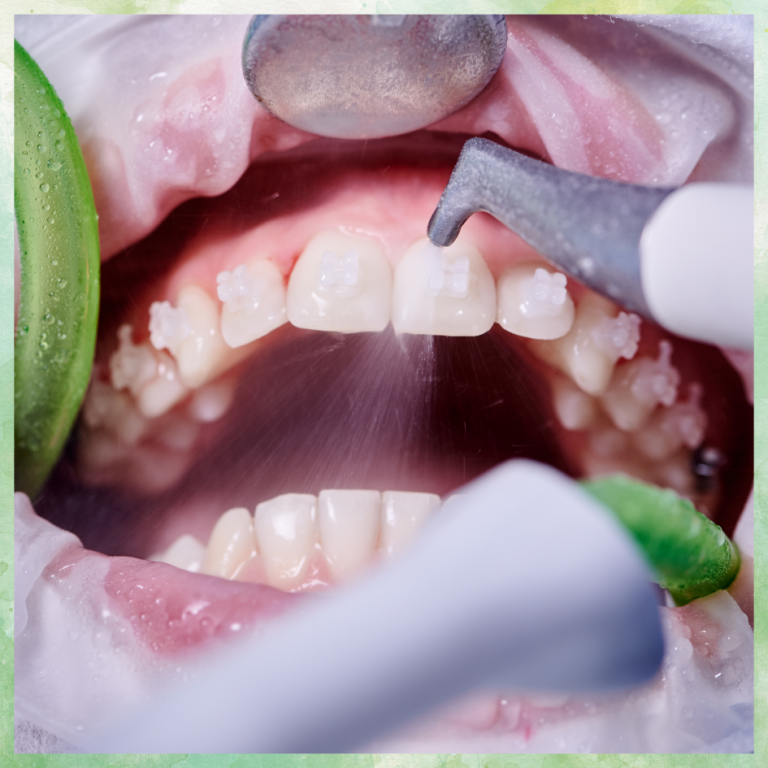 Dentist in Mira Road East