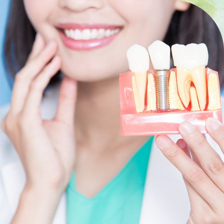 Single Tooth Implant in mira road east