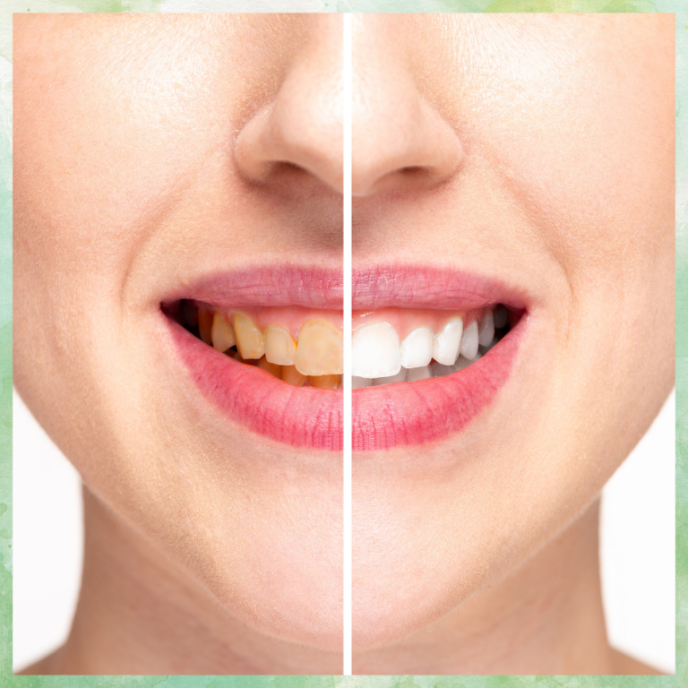 Dentist in Mira Road East