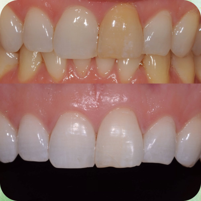 Cosmetic Dentistry in Mira Road East